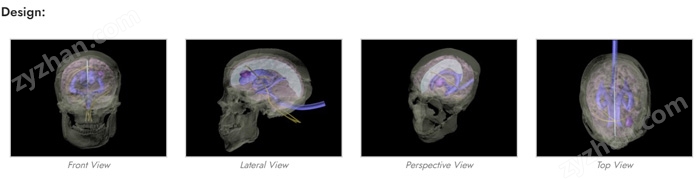 WEK-DSA03成人頭部模型,WEK-DSA03頭部模體設計示圖